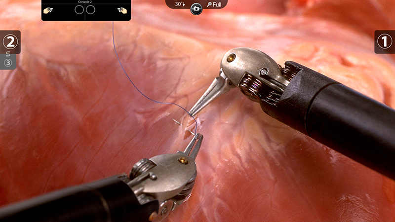 Robô realizando cirurgia urológica